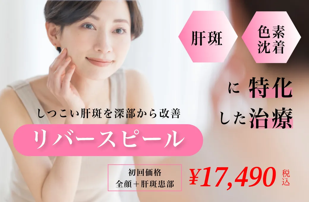 リバースピール金額がわかるバナー写真