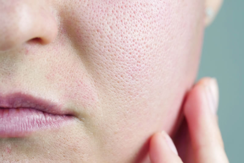 イオン導入薬剤トラネキサム酸のイメージ画像