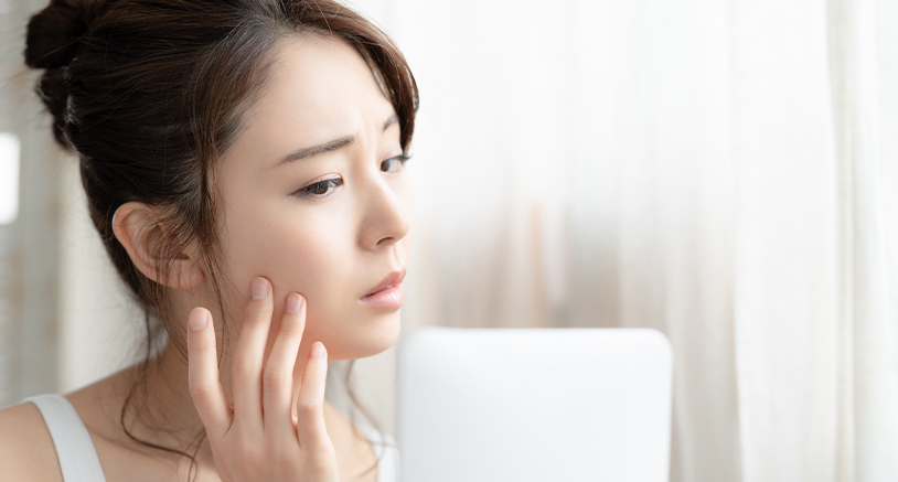 肌トラブルで悩んでいる若い女性の写真