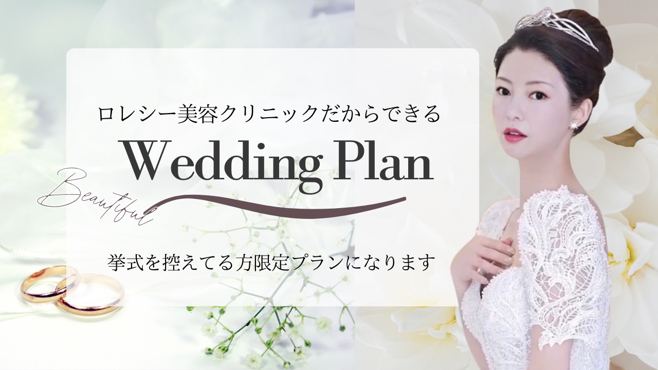 ウエディングプランのバナー写真