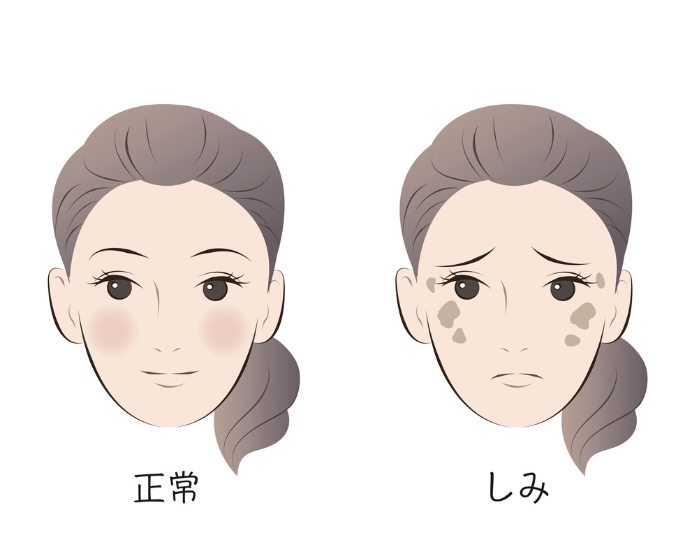 肌へのダメージ・痛みが少ない・デリケートな方でも脱毛可能