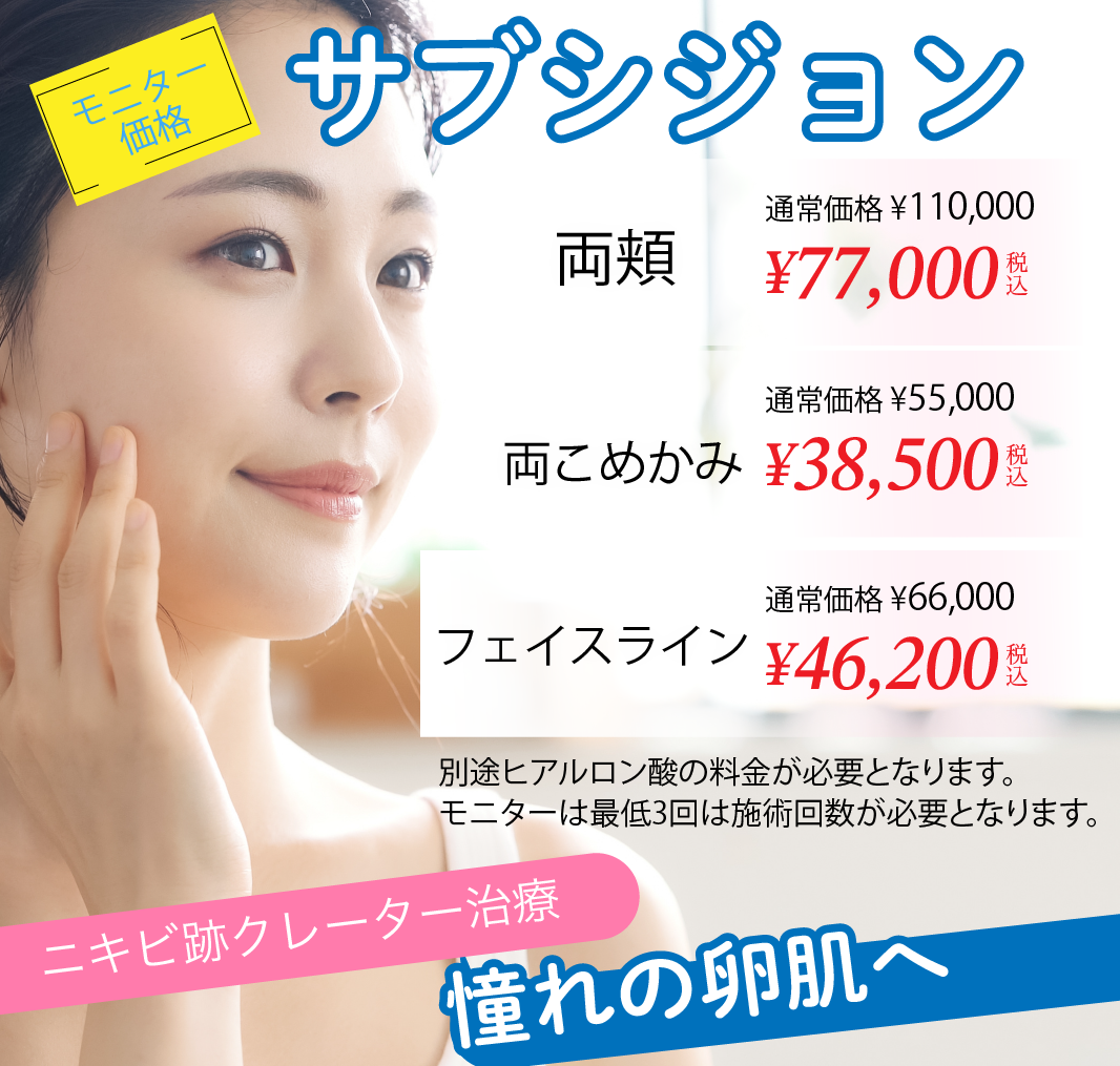 サブシジョンモニターバナー写真