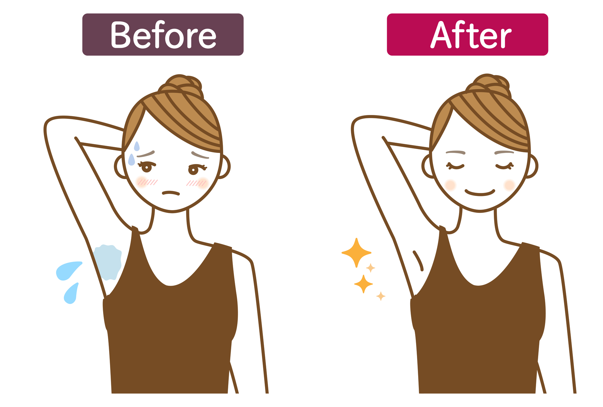 多汗症をイメージするイラスト