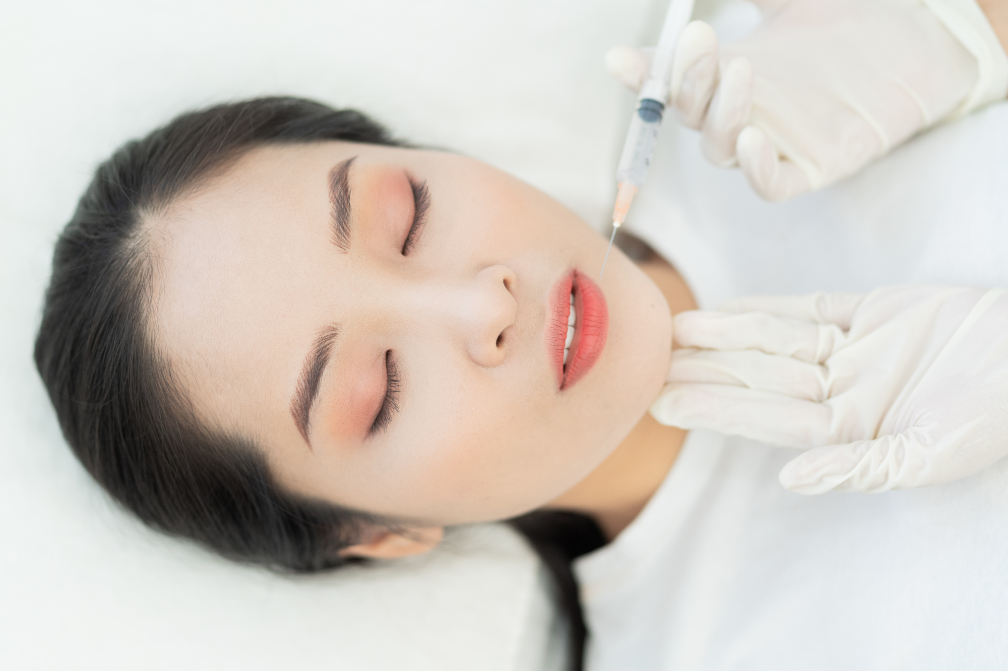 ヒアルロン酸注入の施術を受ける女性の写真