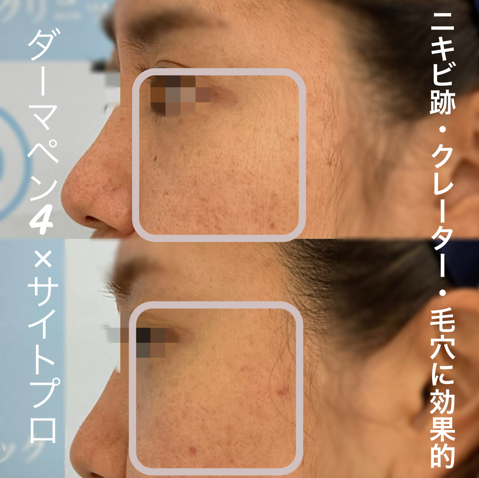 ヴェルベットスキン 症例写真