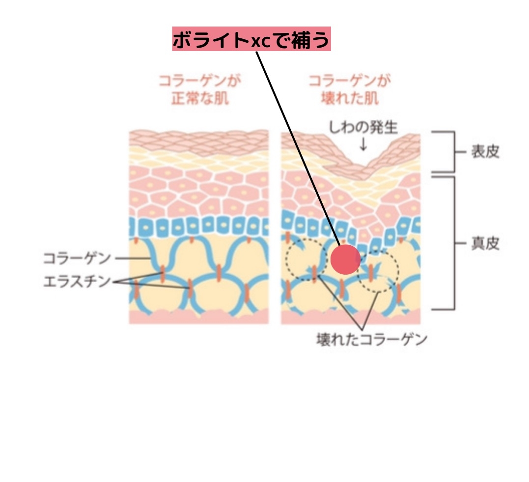 ヒアルロン酸ボライトXCの特徴をイメージしたイラスト