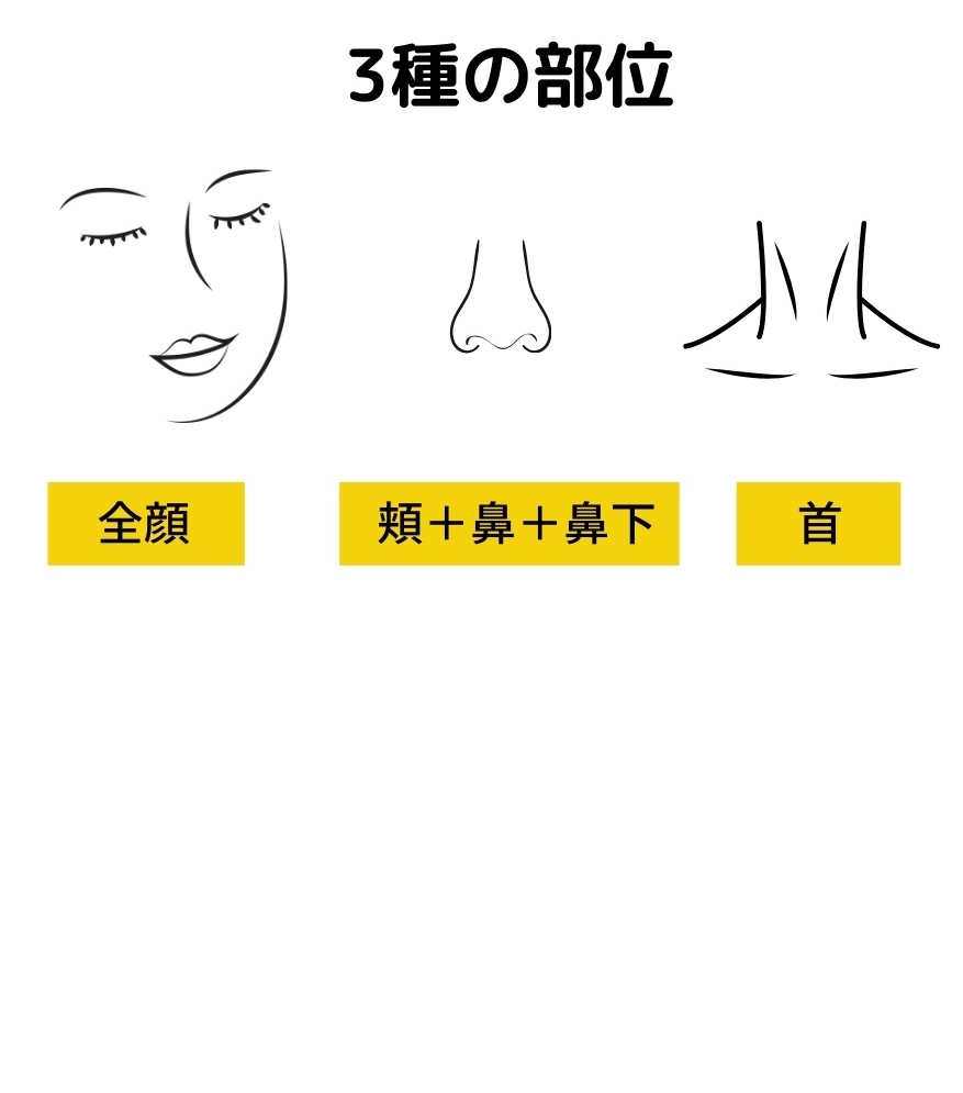 3パターンある施術部位のイラスト