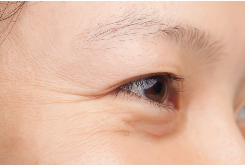 手打ち水光注射