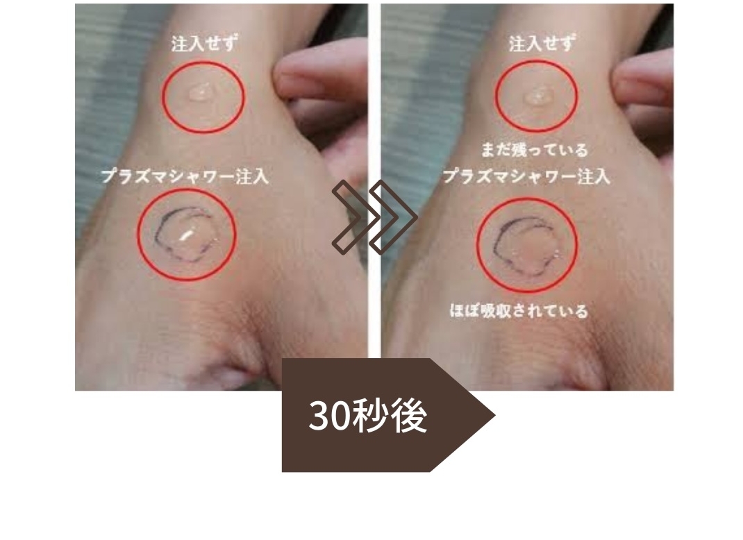 プラズマシャワー 照射後に薬剤の浸透率が比較できる写真