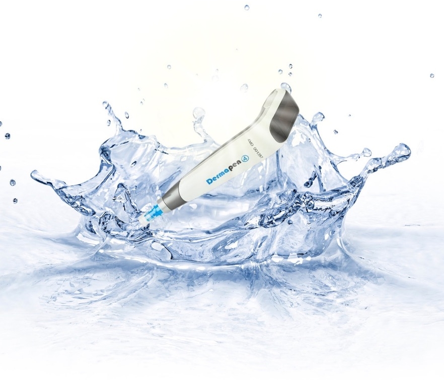 医療ハイフを照射したときに起こる肌内部のイメージイラスト