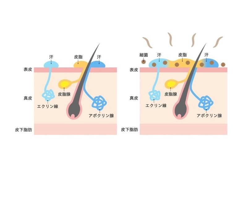 汗腺が分かるイラスト